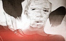 Lại tử vong vì cưa bom