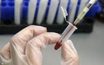 ​Bé có cần nhịn ăn, nhịn uống sữa trước khi lấy máu xét nghiệm