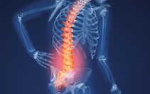 Nắn cột sống khi đau lưng có hiệu quả