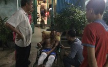 Nổ bình ga trong phòng trọ, hai người bị thương