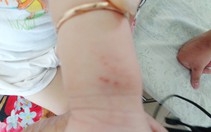 Mèo rắn cắn nhau, bé lãnh đủ