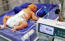 Mổ cứu bé sinh non bị thoát vị nội tạng