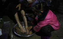 Mẹ bỏ đi, bé gái 5 tuổi tự chăm sóc hai người bà