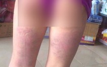 Khiển trách cô giáo dùng thước đánh học sinh