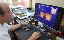 Mổ nâng ngực coi chừng co bao xơ, chảy máu bên trong