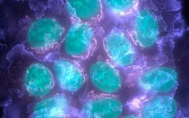​Xác định được các gene đột biến có khả năng gây bệnh ung thư vú