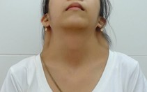 Tạo hình dị tật mang cánh bướm ở cổ hiếm gặp
