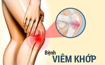 Viêm khớp gối, chỉ cần nghỉ ngơi hay chích thuốc vô khớp?