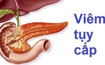 Viêm tụy cấp, có bỏ rượu thì mới không gặp...ông bà sớm!