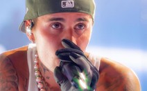Justin Bieber bị liệt nửa mặt do nhiễm virus hiếm
