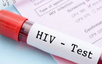 Xử trí sau khi bị phơi nhiễm HIV do nghề nghiệp