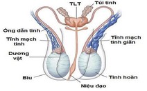 Giãn tĩnh mạch tinh ở tuổi thiếu niên