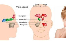 Viêm xoang mạn tính kéo dài do trào ngược dạ dày-thực quản