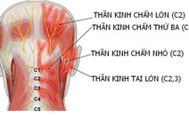 Đau dây thần kinh chẩm