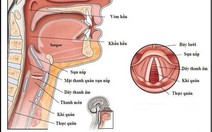 Dấu hiệu mềm sụn thanh quản ở trẻ nhỏ