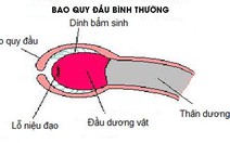 Đừng đưa bé đi nong bao quy đầu quá sớm!