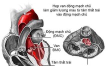 Bộ Y tế bỏ dự định khám sinh dục trong tiêu chuẩn sức khỏe lái tàu