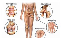 Thoái hóa khớp ở người cao tuổi