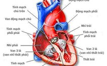 Bệnh tim bẩm sinh ở trẻ em