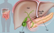 Ba bệnh viện phối hợp điều trị thai phụ bị bệnh hiếm gặp