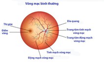 Bệnh đái tháo đường ảnh hưởng lên mắt như thế nào?