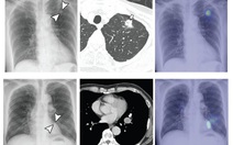 Trí tuệ nhân tạo giảm áp lực cho y bác sĩ lẫn người bệnh