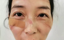 Bác sĩ ở Vũ Hán phải mặc tã làm việc, bị đánh và thiếu tiếp tế
