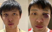 Phản đối phân biệt chủng tộc vì COVID-19, du học sinh Singapore bị hành hung ở London