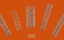 Australia tạo đột phá trong sản xuất stent nhờ công nghệ in 3D