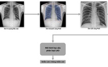 Phát hành sách trắng về ứng dụng trí tuệ nhân tạo cho chẩn đoán và tầm soát bệnh lao