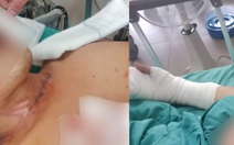 Bị dây diều cứa rách cổ khi đang chạy xe máy trên cầu Thủ Thiêm 1