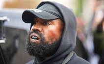 Kanye West chi hơn 20 tỉ đồng để độ hàm răng