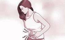 Vì sao nhiều chị em đau bụng khi đến kỳ kinh?