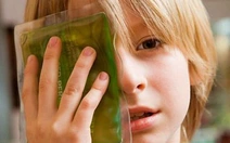 Bé trai 12 tuổi bị vỡ thủy tinh thể do cọng kẽm cắm vào mắt