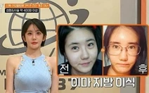 Người phụ nữ thay đổi thế nào sau hơn 400 lần thẩm mỹ?