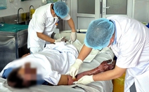 Sửa chuồng gà, người đàn ông bị bỏng nặng do tia hồ quang