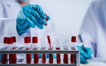 Bốn xét nghiệm nên thực hiện sau tuổi 40 để sống khỏe mạnh hơn