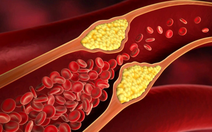 Chế độ ăn phòng tăng mỡ máu ở người cao tuổi