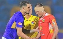 Trọng Hoàng bị Hoàng Hên giậm rách gần lìa tai trái