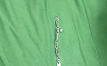 Bé gái 5 tuổi nuốt vòng tay bạc dài 7cm, sơ cứu đúng cách giúp trẻ thoát nguy hiểm