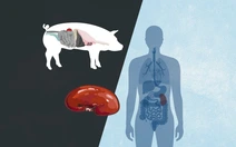 Vì sao Mỹ ghép tạng heo cho người nhưng cấm tạo tạng người trong heo?