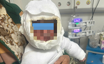 Bé 9 tháng tuổi bỏng 30% cơ thể vì kéo dây điện ấm siêu tốc