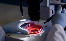 Công nghệ hình ảnh siêu nhạy giúp phát hiện ung thư sớm