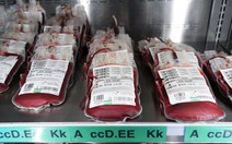 Nhóm máu liên quan đến nguy cơ mắc ung thư dạ dày