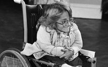 Diễn viên Melanie Watson mắc bệnh xương thủy tinh qua đời ở tuổi 57