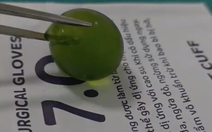 Nuốt phải hạt nở, bé 13 tháng tuổi nôn ói, tắc ruột