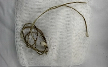 Nam sinh phải mổ khẩn vì dây sạc điện thoại trong bàng quang sau khi bắt chước clip trên mạng