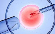 Em bé đầu tiên trên thế giới chào đời nhờ IVF tự động điều khiển từ xa