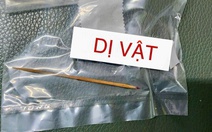 Lấy chiếc tăm nhọn dài 7cm nằm hơn 4 tháng trong bụng một bé trai