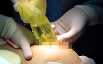 Bộ Y tế vào cuộc vụ bệnh nhân tử vong sau khi nâng ngực và hút mỡ tại TP.HCM